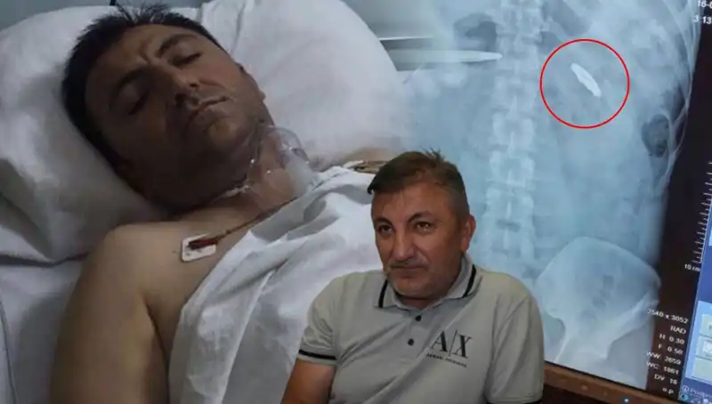 15 Temmuz’un Acı Mirası: Vücudundaki Kurşunla Yaşayan Kahraman