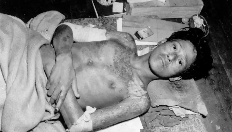 80 Yıl Sonra Nagasaki Uyarısı: Nükleer Felaket Tehdidi Gerçekleşiyor