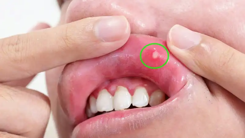 Vücudunuzun Alarm Zilleri: 5 B Vitamini Eksikliği Belirtisi